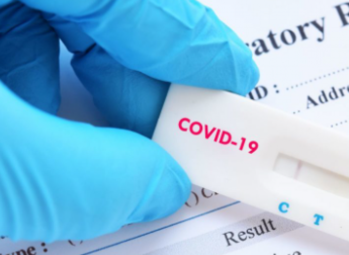 Δωρεάν δειγματοληπτικά τεστ για Covid-19 την Πέμπτη στη Νάξο
